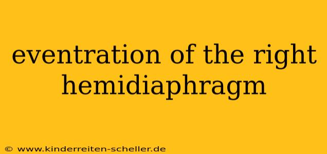 eventration of the right hemidiaphragm