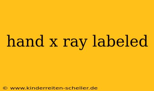 hand x ray labeled