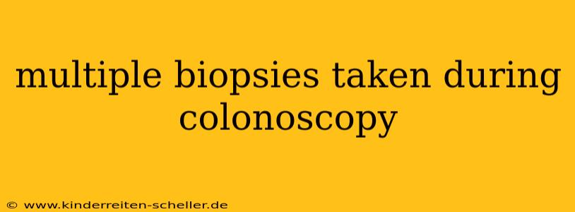 multiple biopsies taken during colonoscopy