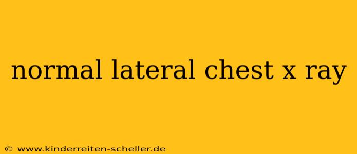 normal lateral chest x ray